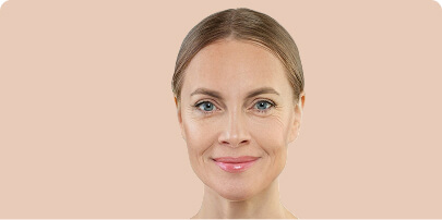 Woman facing forward with clear skin